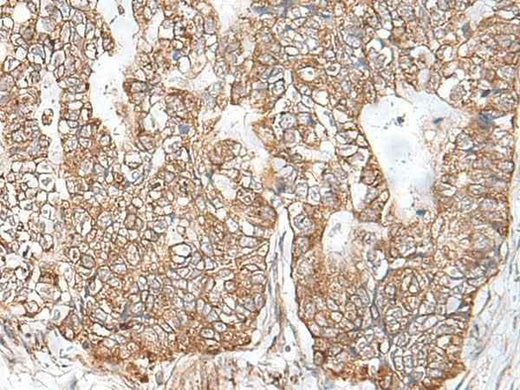 Anti-Human RNF111 Antibody