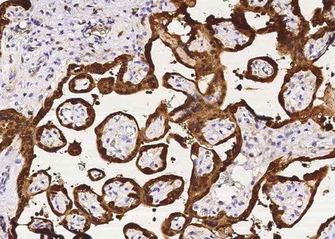 Anti-Human PNP Antibody [B340] - ABMIUM
