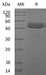 Recombinant Mouse Cathepsin E/CTSE Protein (aa 60-397, His Tag) - ABMIUM
