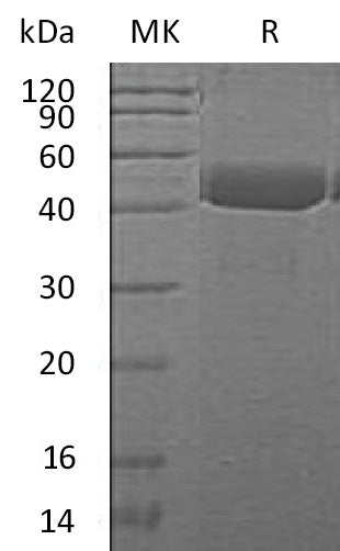 Recombinant Mouse Cathepsin E/CTSE Protein (aa 60-397, His Tag) - ABMIUM