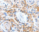 Anti-Human LRIG3 Antibody - ABMIUM