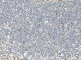 Immunohistochemistry of paraffin-embedded Human tonsil tissue using IFNA2 Polyclonal Antibody at dilution of 1:40(×200)