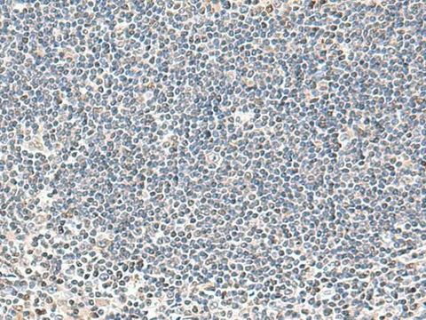 Immunohistochemistry of paraffin-embedded Human tonsil tissue using IFNA2 Polyclonal Antibody at dilution of 1:40(×200)