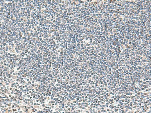 Immunohistochemistry of paraffin-embedded Human tonsil tissue using IFNA2 Polyclonal Antibody at dilution of 1:40(×200)