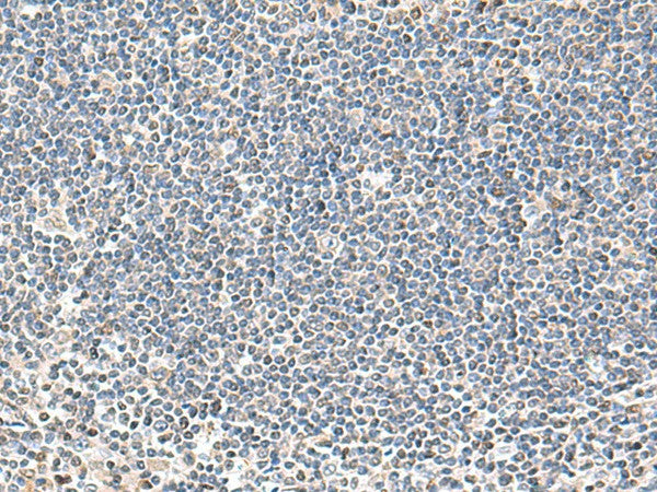 Immunohistochemistry of paraffin-embedded Human tonsil tissue using IFNA2 Polyclonal Antibody at dilution of 1:40(×200)