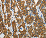 Anti-Human/Mouse/Rat PRDX5 Antibody - ABMIUM