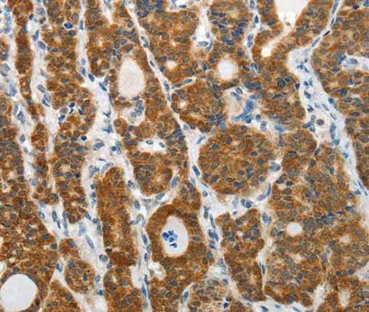 Anti-Human/Mouse/Rat PRDX5 Antibody