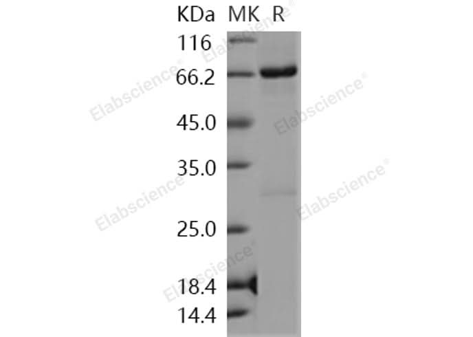 > 91 % as determined by reducing SDS-PAGE.