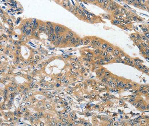 Anti-Human/Rat ANKZF1 Antibody