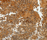 Anti-Human/Mouse/Rat TFF2 Antibody - ABMIUM