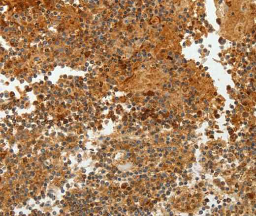 Anti-Human/Mouse/Rat TFF2 Antibody