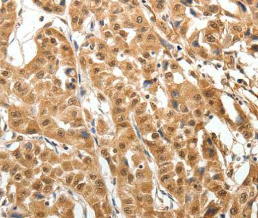 Anti-Human MAP1A Antibody