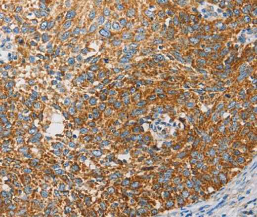 Anti-Human APOBEC3G Antibody