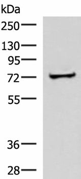 Western blot analysis of Human liver tissue lysate using ZNF263 Polyclonal Antibody at dilution of 1:500