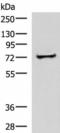 Western blot analysis of Human liver tissue lysate using ZNF263 Polyclonal Antibody at dilution of 1:500