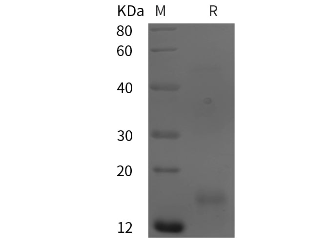SDS-PAGE analysis of Human TIMP3 proteins, 2 μg/lane of Recombinant Human TIMP3 proteins was resolved with SDS-PAGE under reducing conditions, showing bands at 15 kDa.