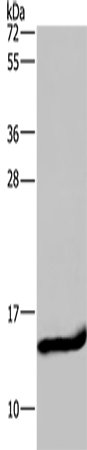 Anti-Human/Mouse/Rat FABP2 Antibody - ABMIUM
