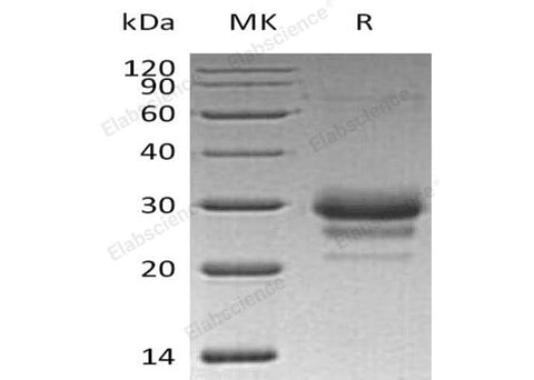 Recombinant Human TFPI2 Protein (His Tag) - ABMIUM
