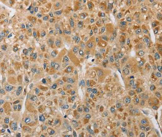 Anti-Human/Mouse/Rat MIP Antibody