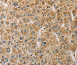 Anti-Human/Mouse/Rat MIP Antibody - ABMIUM