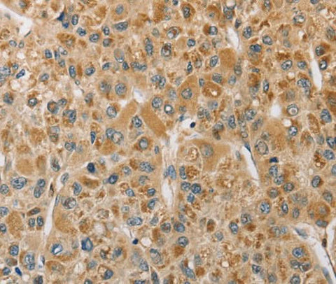 Anti-Human/Mouse/Rat MIP Antibody - ABMIUM