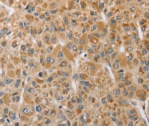 Anti-Human/Mouse/Rat MIP Antibody - ABMIUM