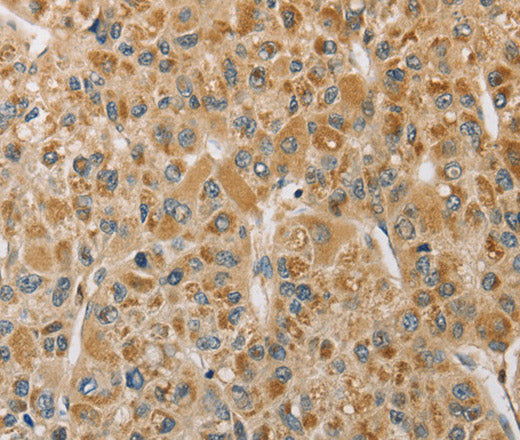Anti-Human/Mouse/Rat MIP Antibody - ABMIUM