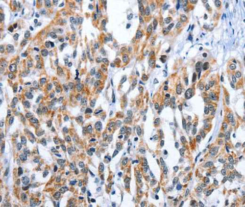 Anti-Human EDN3 Antibody