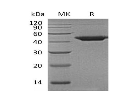 Recombinant Human Wnt Inhibitory Factor 1/WIF1 Protein (His Tag) - ABMIUM