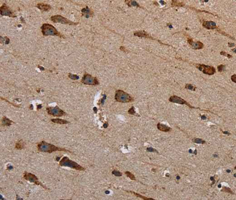 Anti-Human/Mouse PLXNB1 Antibody