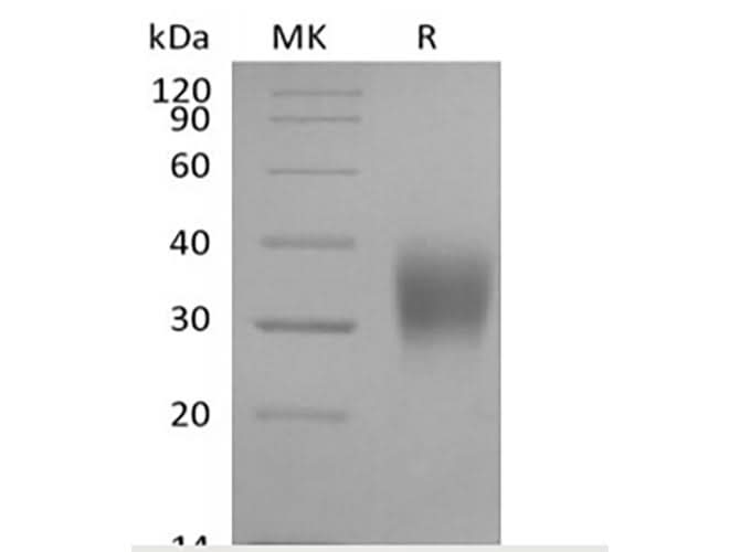 Recombinant Cynomolgus Fc gamma RIIIA/FCGR3A/CD16a (C-6His) - ABMIUM