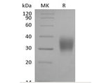 Recombinant Cynomolgus Fc gamma RIIIA/FCGR3A/CD16a (C-6His) - ABMIUM