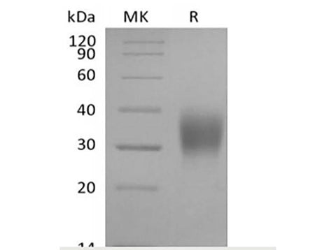 Recombinant Cynomolgus Fc gamma RIIIA/FCGR3A/CD16a (C-6His) - ABMIUM
