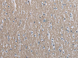 Immunohistochemistry of paraffin-embedded Human brain tissue using SLC39A14 Polyclonal Antibody at dilution of 1:40(×200)
