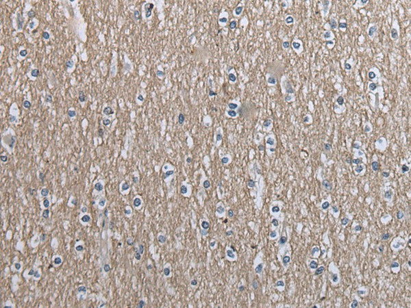 Immunohistochemistry of paraffin-embedded Human brain tissue using SLC39A14 Polyclonal Antibody at dilution of 1:40(×200)