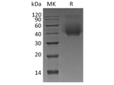 Recombinant Human CD44 Protein (His Tag) - ABMIUM