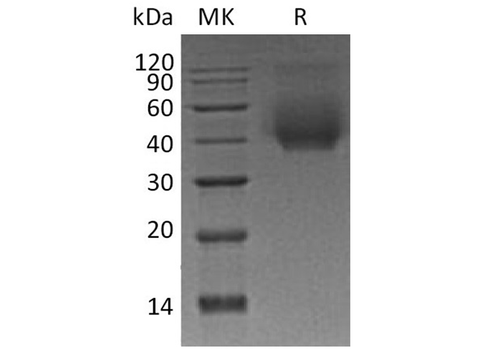 Recombinant Human CD44 Protein (His Tag) - ABMIUM