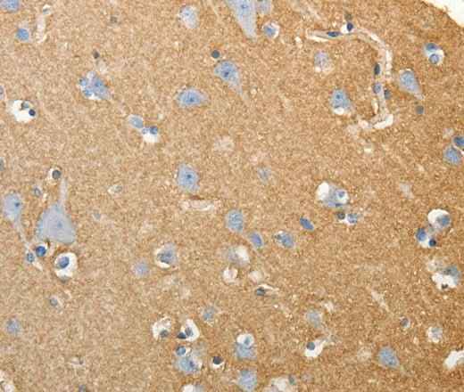 Anti-Human/Mouse/Rat SLC4A4 Antibody