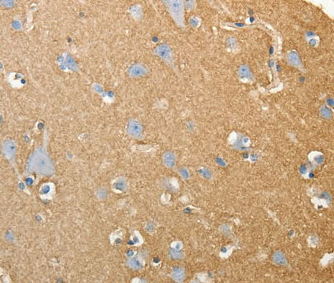 Anti-Human/Mouse/Rat SLC4A4 Antibody - ABMIUM
