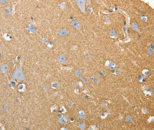 Anti-Human/Mouse/Rat SLC4A4 Antibody - ABMIUM