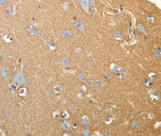 Anti-Human/Mouse/Rat SLC4A4 Antibody - ABMIUM