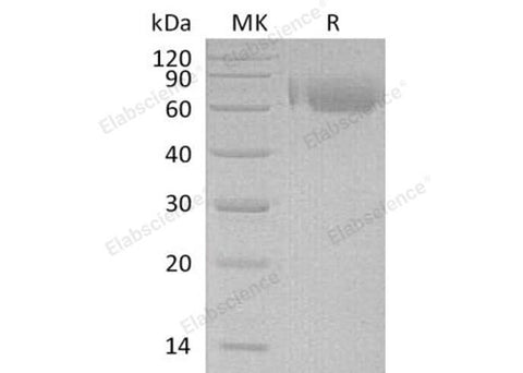 Recombinant Human LILRA2/ILT1 Protein (His Tag) - ABMIUM