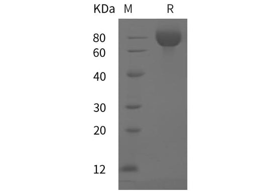 SDS-PAGE analysis of Mouse ALCAM/CD166 proteins, 2 μg/lane of Recombinant Mouse ALCAM/CD166 proteins was resolved with SDS-PAGE under reducing conditions, showing bands at 75 kDa.