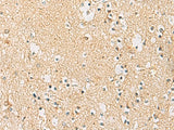 Immunohistochemistry of paraffin-embedded Human brain tissue using IDS Polyclonal Antibody at dilution of 1:70(×200)