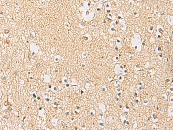 Immunohistochemistry of paraffin-embedded Human brain tissue using IDS Polyclonal Antibody at dilution of 1:70(×200)