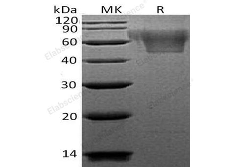 Recombinant Human CX3CL1/Fractalkine Protein (His Tag) - ABMIUM