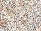 Anti-Human SLC40A1 Antibody - ABMIUM