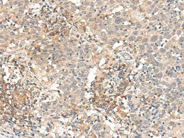 Anti-Human SLC40A1 Antibody