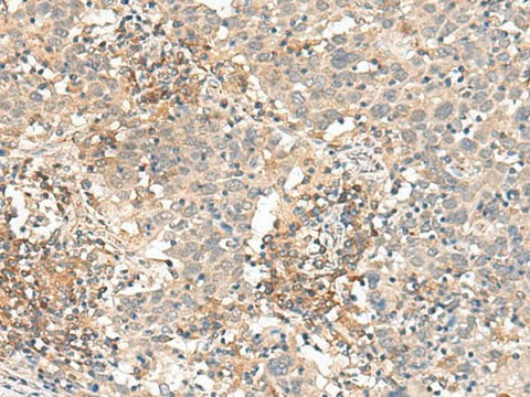 Anti-Human SLC40A1 Antibody - ABMIUM