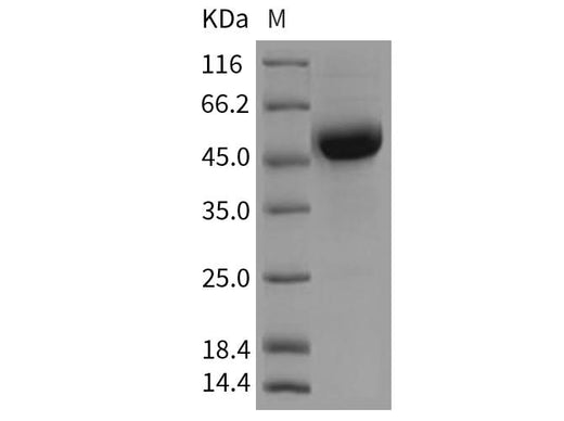 Recombinant Rat CD79B/B29 Protein (Fc Tag) - ABMIUM